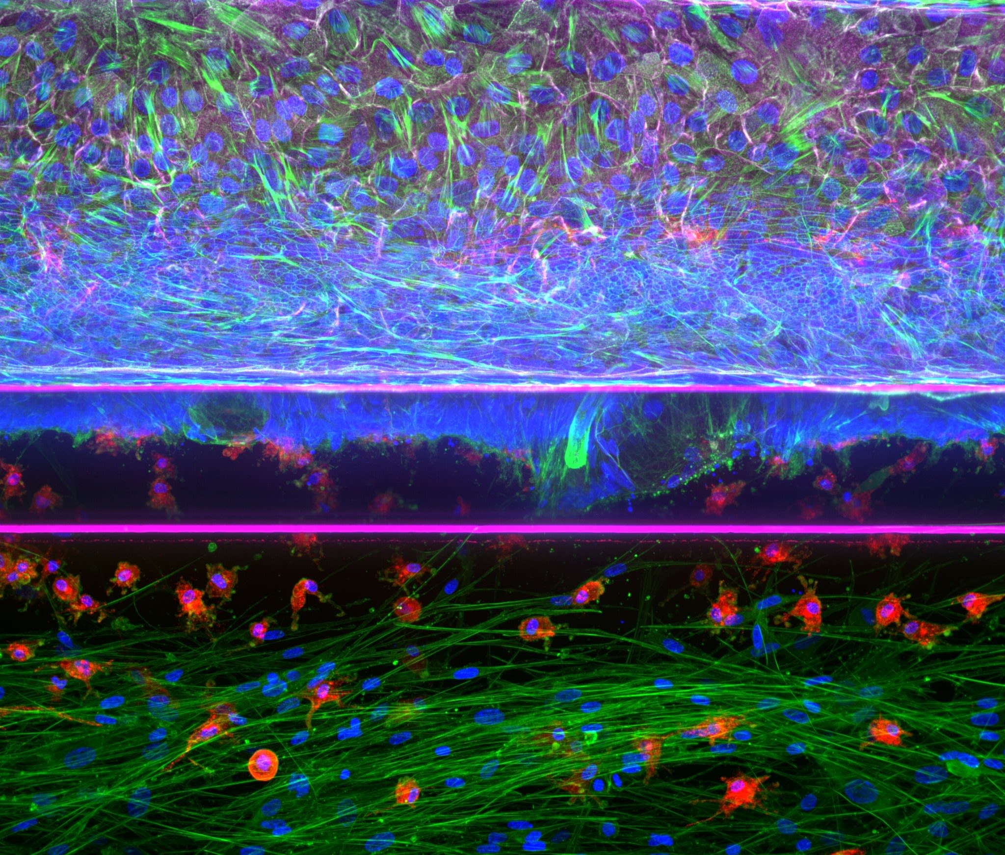 3D intestinal model comprising adult stem cell-derived colon organoids grown as perfused epithelial tubules in stable co-culture with primary macrophages and fibroblasts embedded in ECM